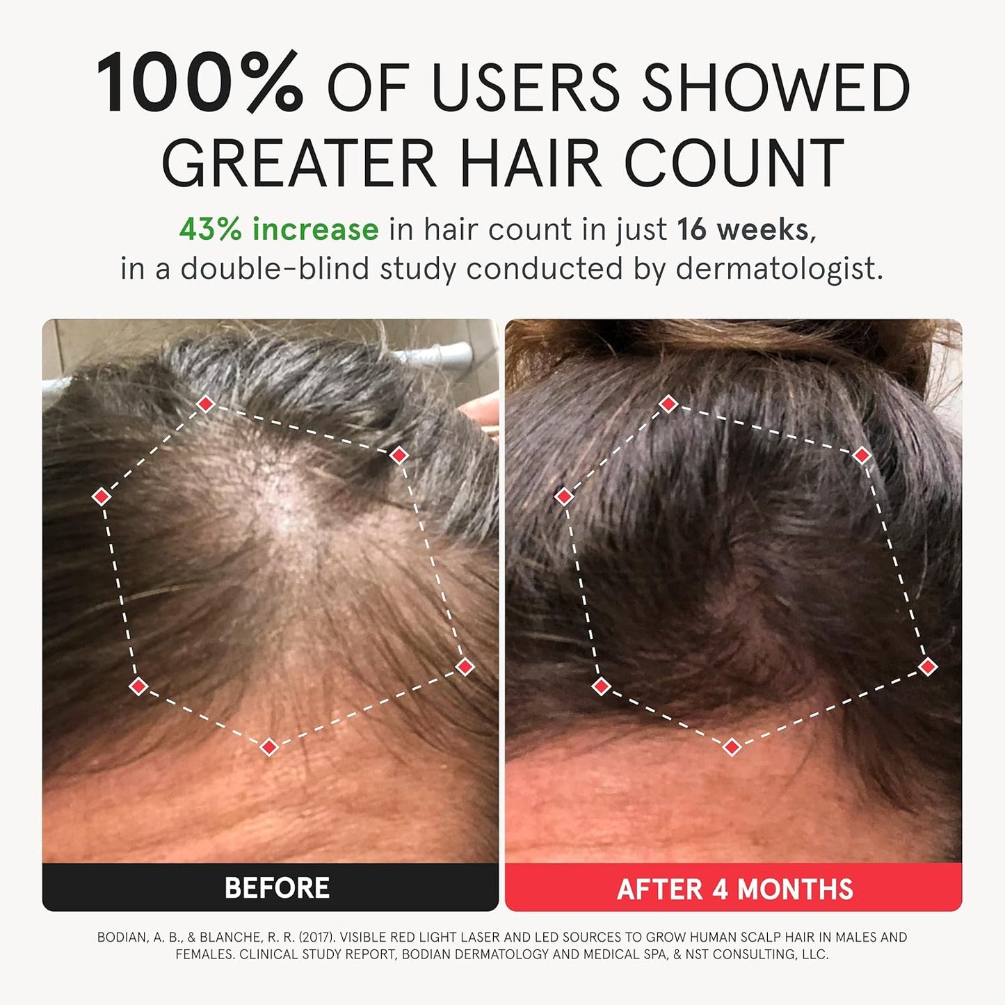 iRESTORE Hair Growth System Elite