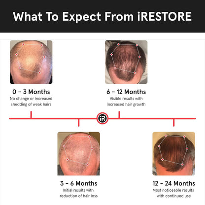 iRESTORE Hair Growth System Essential