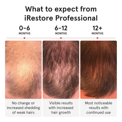 iRESTORE Hair Growth System Professional