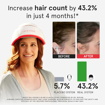 iRESTORE Hair Growth System Professional