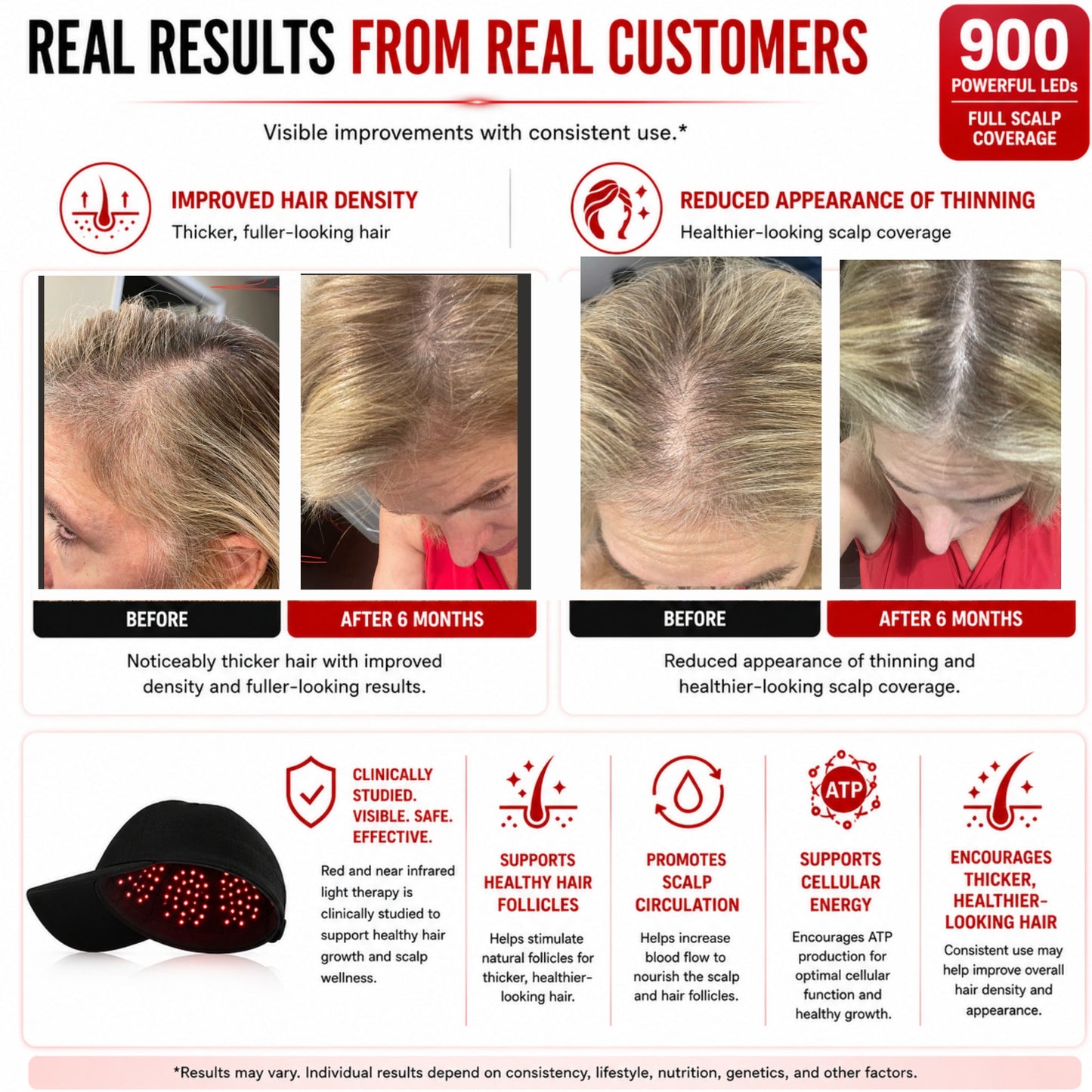 Red Light Therapy Hat – 900 LED Scalp Light Therapy Cap