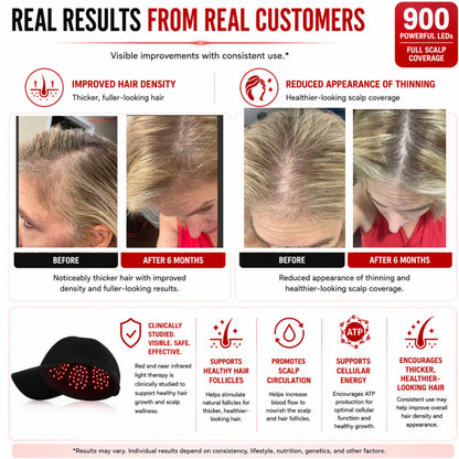 Red Light Therapy Hat – 900 LED Scalp Light Therapy Cap